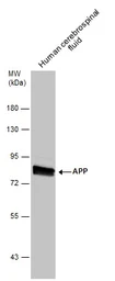 Anti-APP antibody used in Western Blot (WB). GTX112677